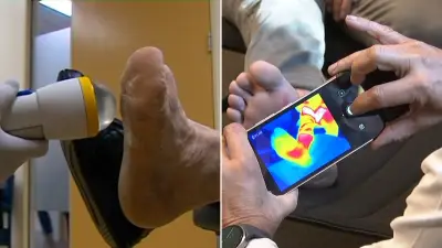 World-first AI camera aims to prevent diabetic amputations
